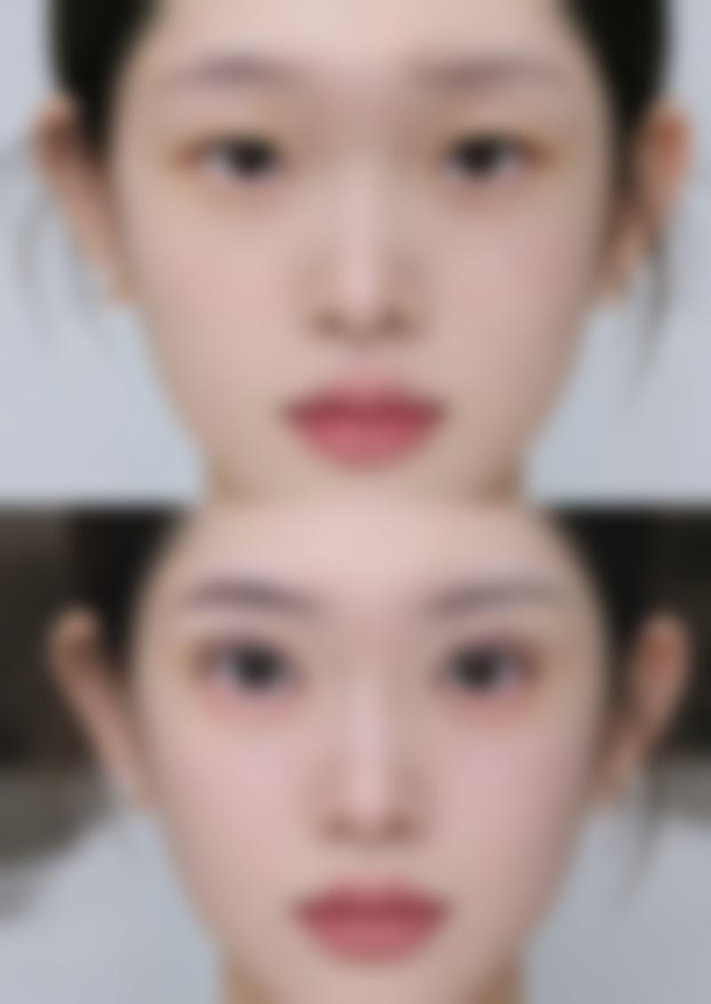 蚌埠韩美美莱医疗美容门诊部历芳医生技术怎么样