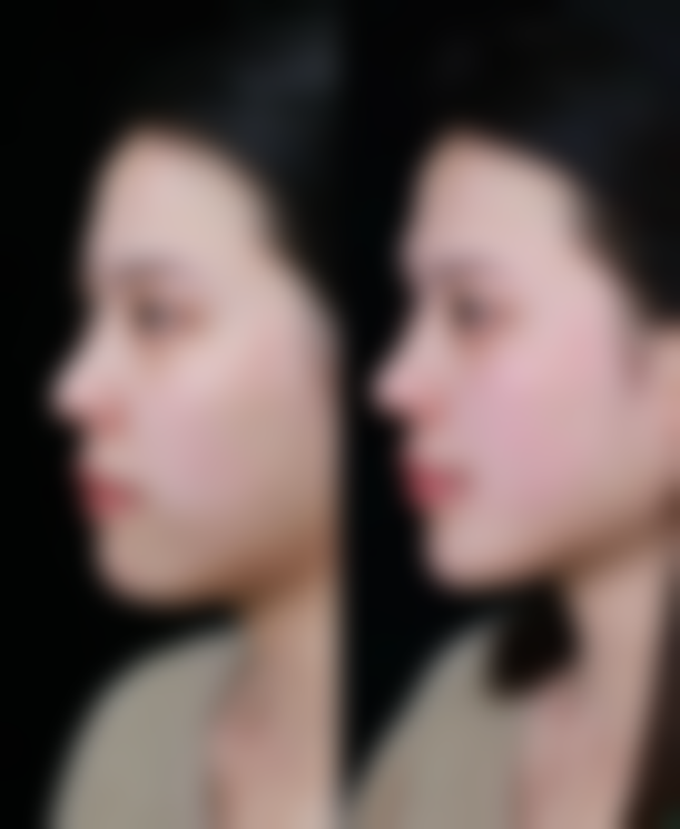 泰州皇盛美医疗美容门诊部预约挂号方式。