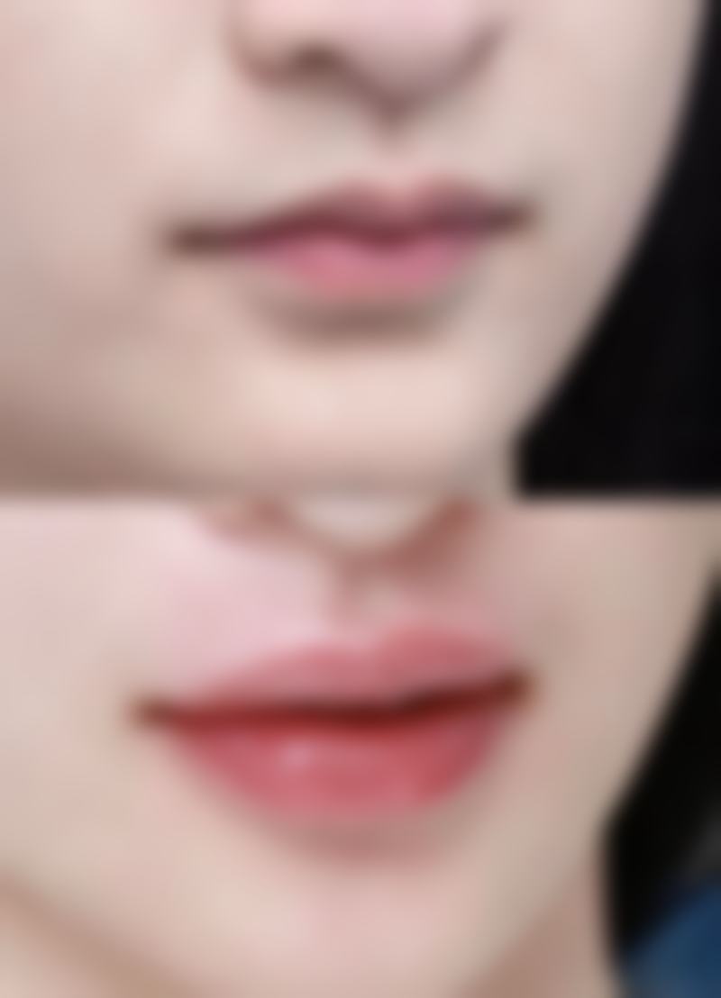 西安莎曼妃整形医疗美容医院口碑评价