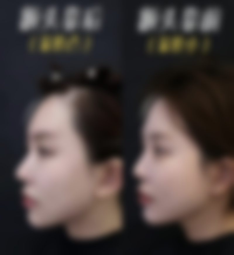 Herb整形外科的乘车路线说明