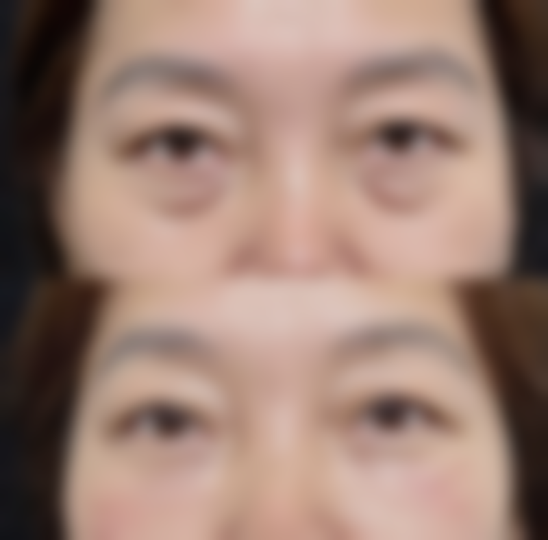 临沂市兰山区兰瑟儿医疗整形美容门诊部收费价格表