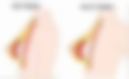 十堰市人民医院烧伤整形外科擅长项目