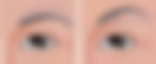 大连卓悦美慧医疗美容诊所汪方医生口碑评价与项目分享：