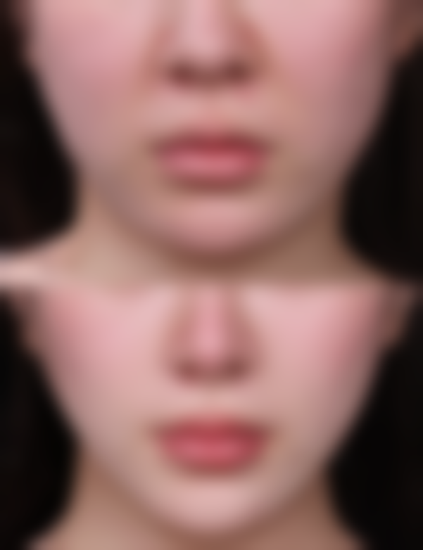 兰州时光激光整形医院何金生医生价格收费表查询