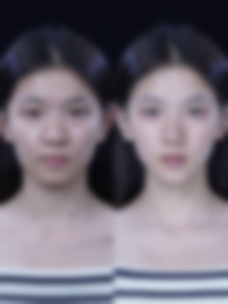 佛山大麦植发整形外科门诊部预约挂号方式。