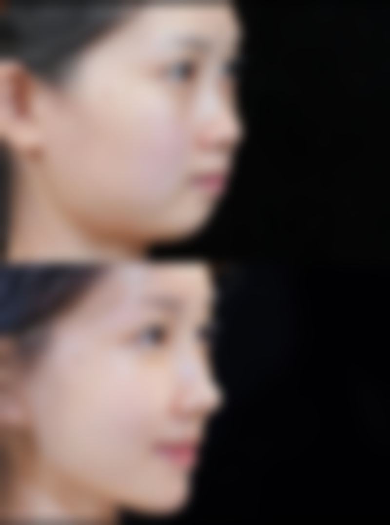 郑州帝尔美整形医院口碑评价与项目分享：