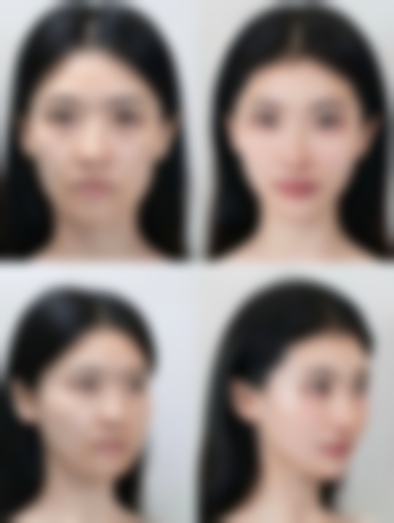 西安莎曼妃整形医疗美容医院的项目价格