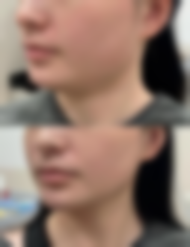 深圳福华中医和西医结合医院医学美容科口碑评价