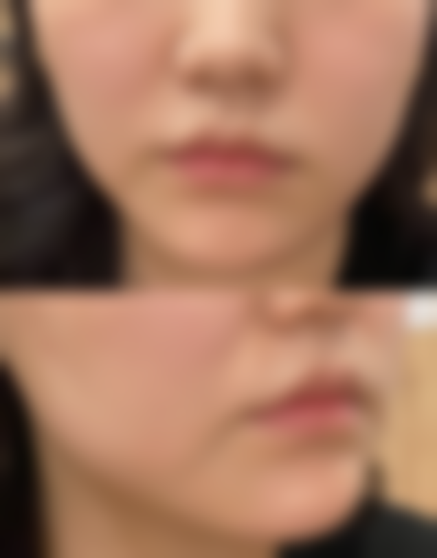 厦门大学附属中山医院整形美容科口碑评价