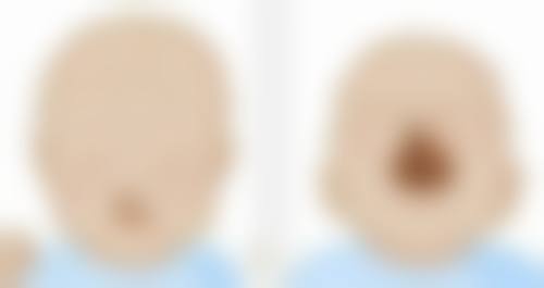 郑州喜美医疗美容门诊部收费价格表