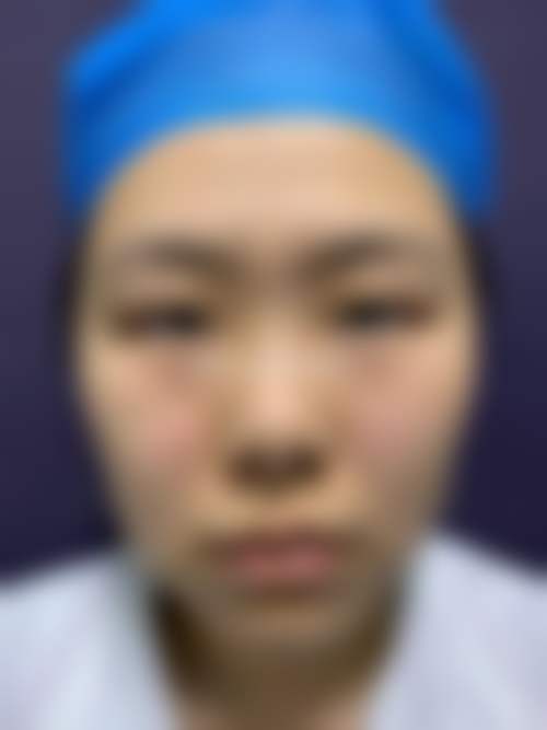 都颢医生的技术实力