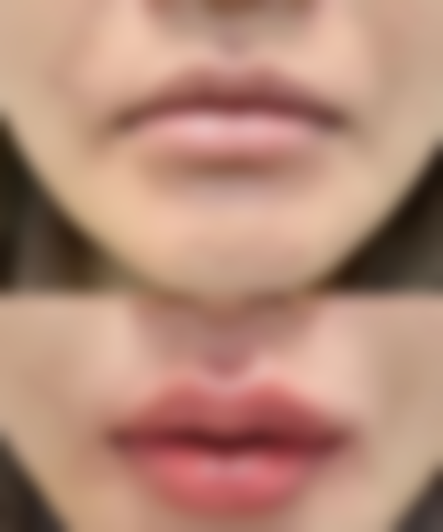 李登进医生坐诊医院