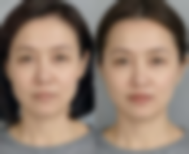 韩国PT（pretty）整形外科擅长项目