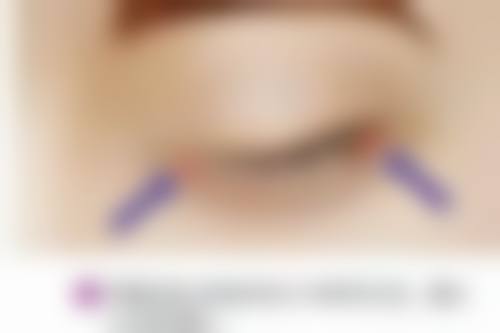 王立峰医生的技术与实力