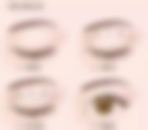 谢冉医生擅长项目