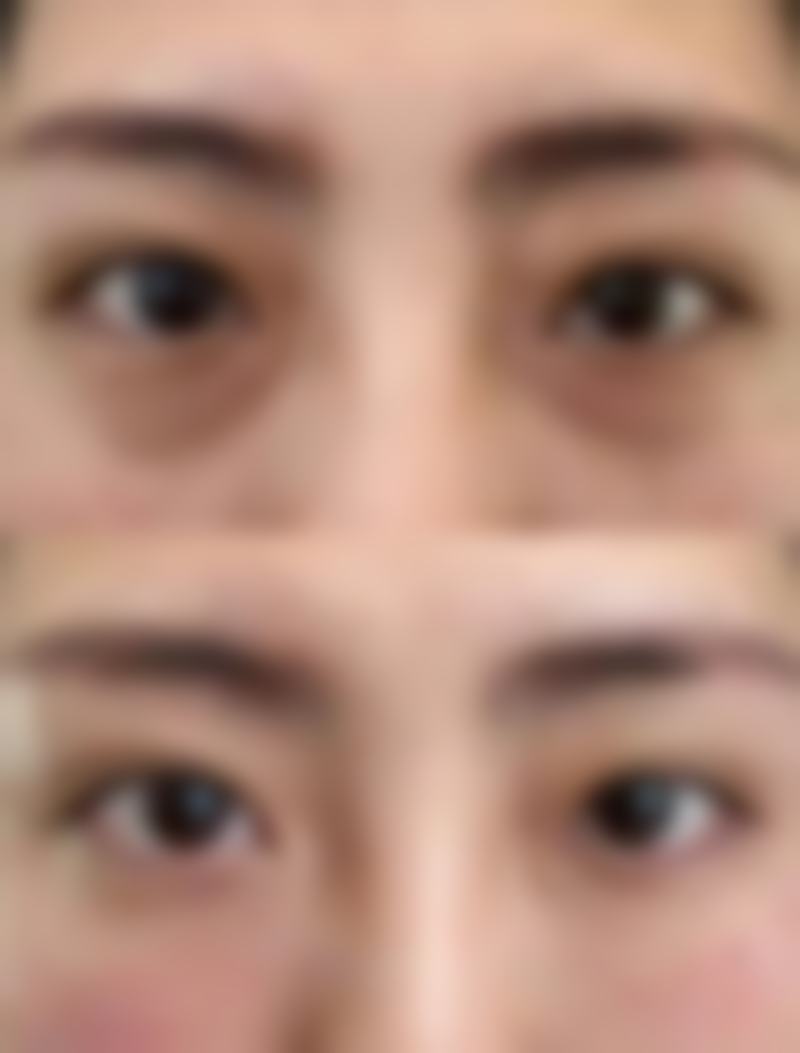 徐陇豫医生的擅长项目