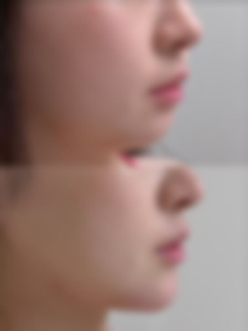 烟台华美医疗美容诊所预约挂号方式