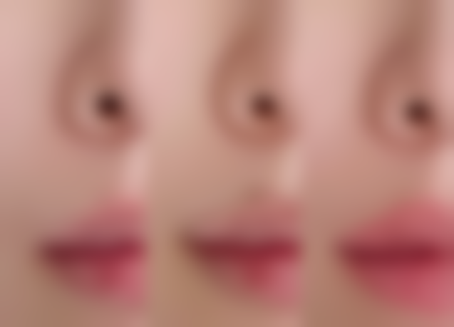 深圳同仁整形医疗美容医院孙月玲医生价格收费表查询