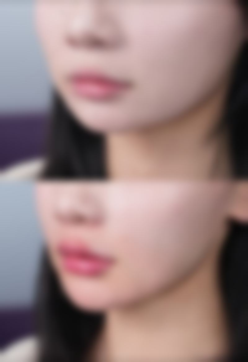 深圳可丽雅医疗美容门诊部擅长项目