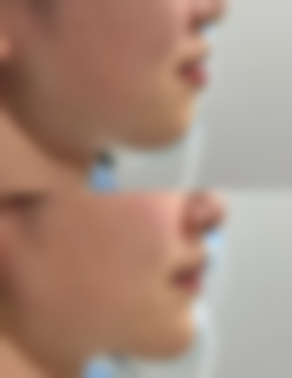 湘南美容仙台院治疗反馈与口碑评价。