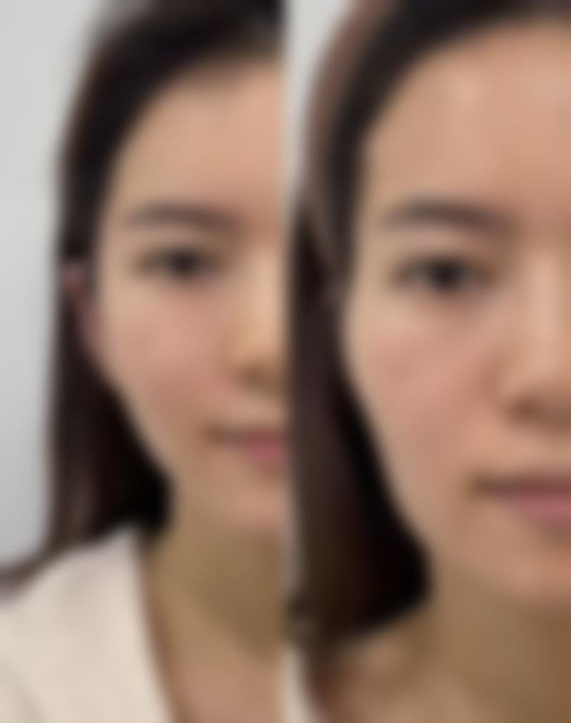 宣城地区医院整形科擅长项目。