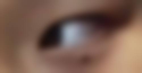 深圳福华中医和西医结合医院医学美容科卢福均医生口碑评价与项目分享：