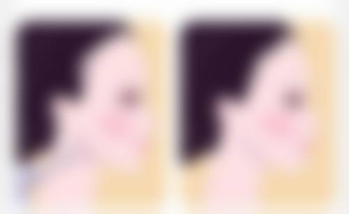 深圳福华中医和西医结合医院医学美容科卢福均医生擅长项目