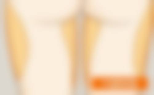 Herb整形外科的擅长项目