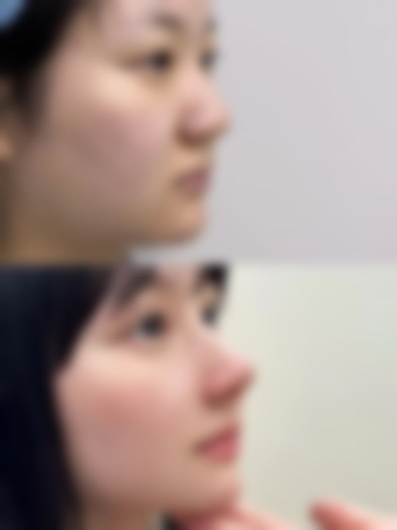 洛阳一览芳华医疗美容门诊部马利峰医生口碑评价与项目分享：