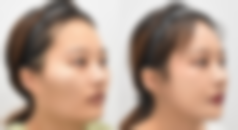 马鞍山福华整形美容门诊部乘车路线：