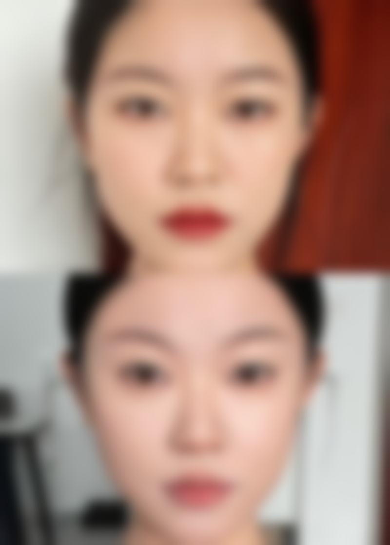 任奎卓医生擅长的项目