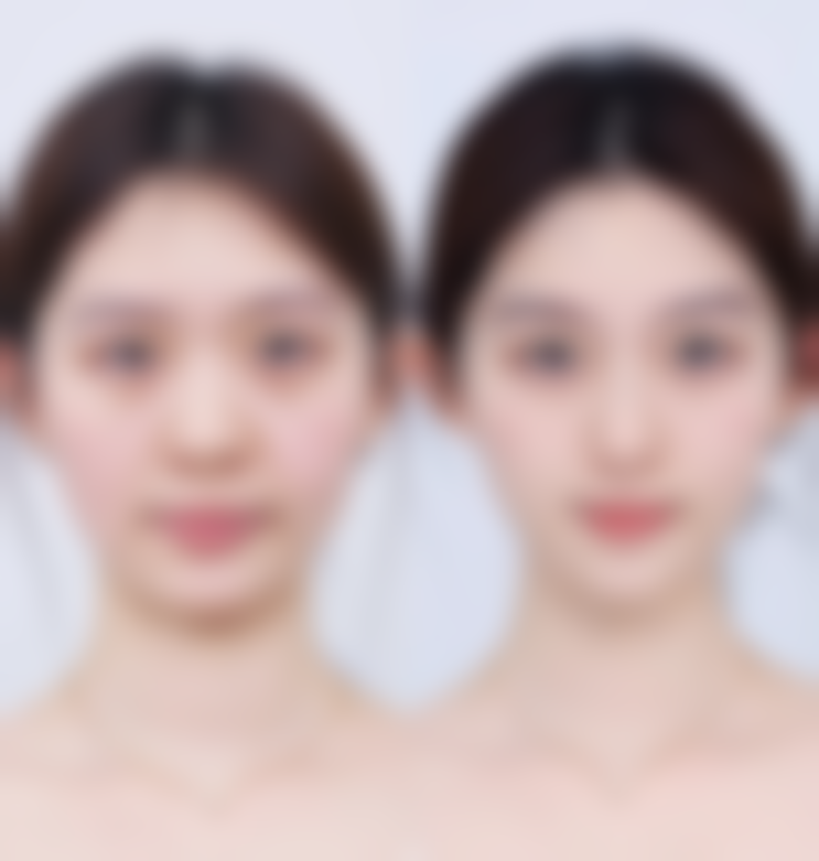 兴义罗孟林医疗美容诊所口碑评价与项目分享