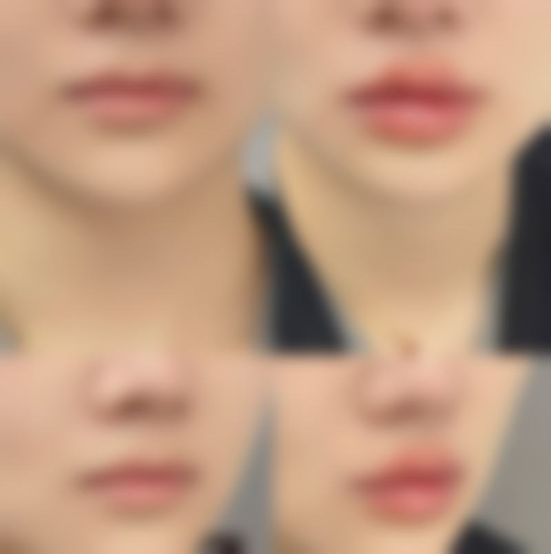 武汉叶子整形美容医院擅长项目