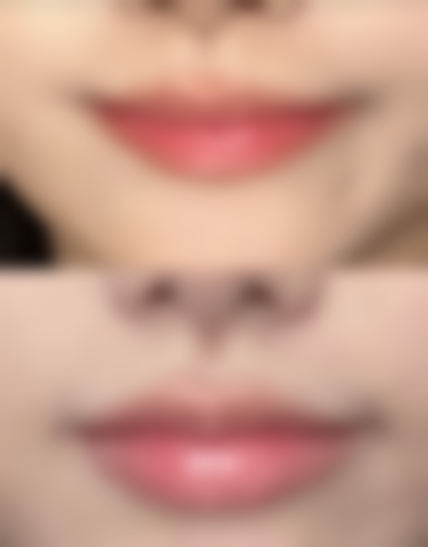 武汉叶子整形美容医院口碑评价与项目分享：