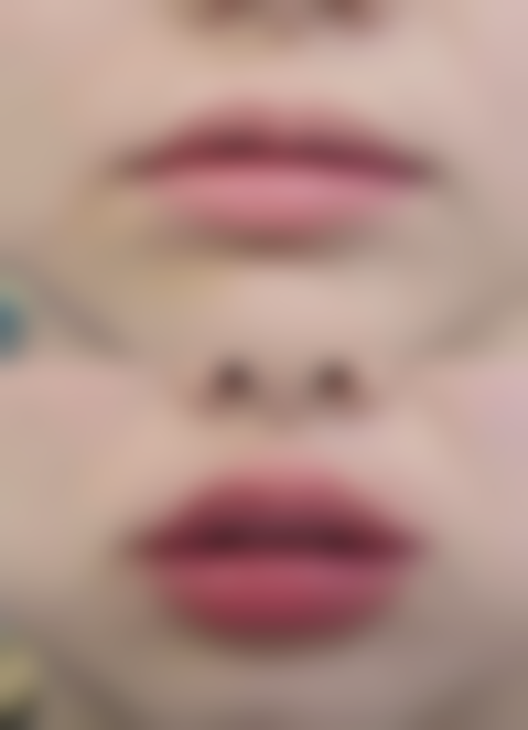 沈阳星美医疗美容诊所治疗反馈与口碑评价。