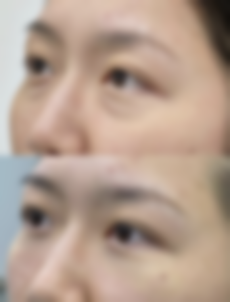 成都忠爱医疗美容诊所治疗反馈与口碑评价。