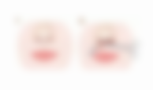 昆山米扬丽格医疗美容治疗反馈与口碑评价。