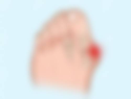 兰州时光激光整形医院逯岩医生口碑评价与项目分享：