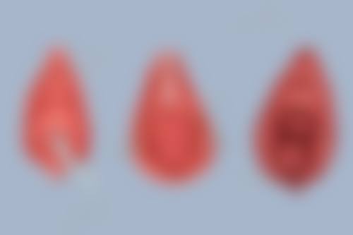 武汉黄为整形医疗美容门诊部地理位置便于到院。