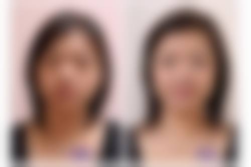 新乡市第二人民医院整形美容科乘车路线：