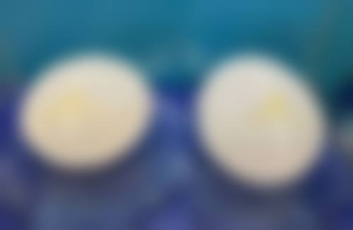 滕州美界医疗美容诊所优势项目