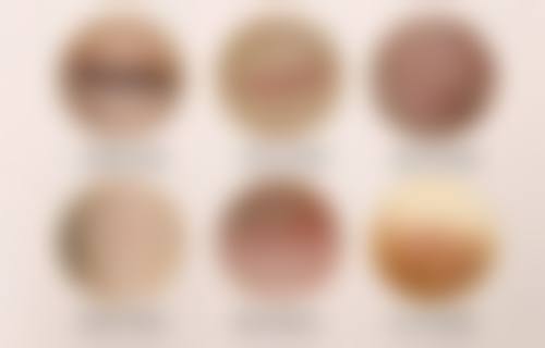 韩国newman男科医院口碑评价与项目分享