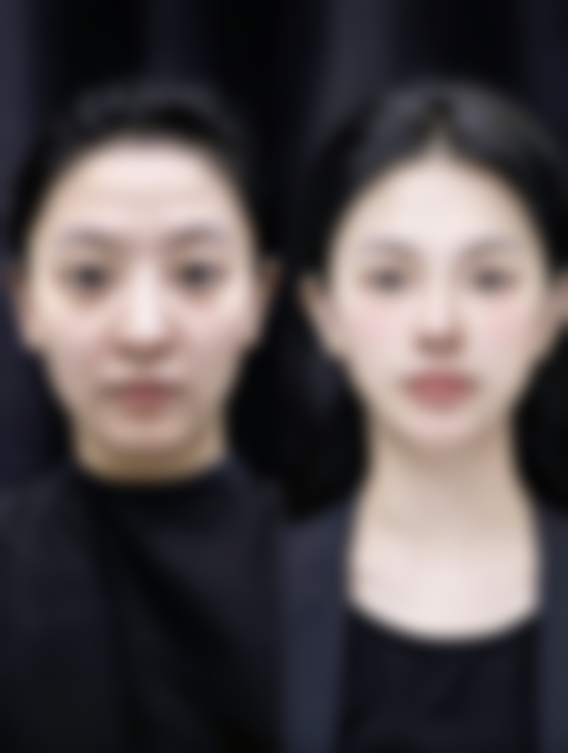 兰州时光激光整形医院逯岩医生价格收费表查询