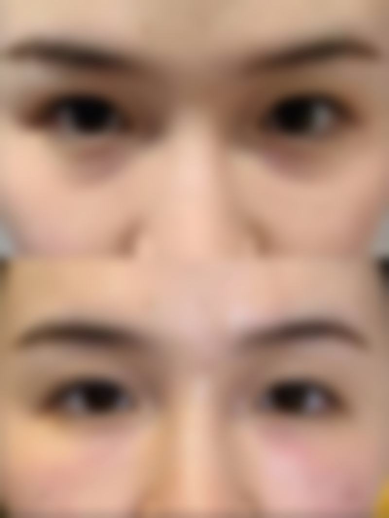 长沙罗曼丽黄氏整形医院收费价格表