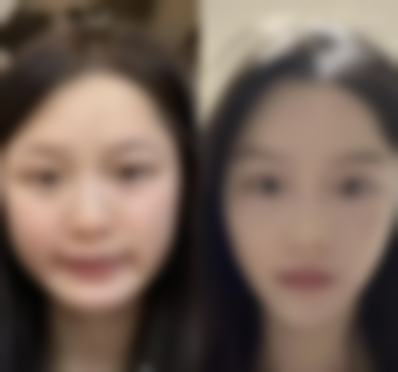 武汉黄为整形医疗美容门诊部治疗反馈与口碑评价。