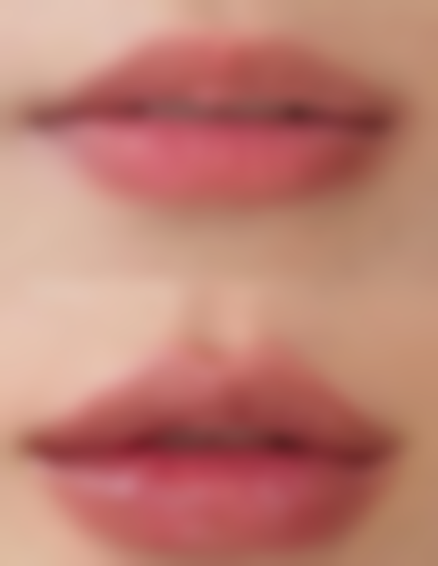 邢台臻悦医疗美容门诊部王僧会医生价格收费表查询