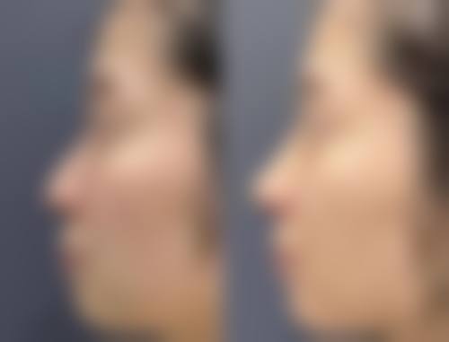 南宁市红十字会医院整形美容地理位置便于到院。