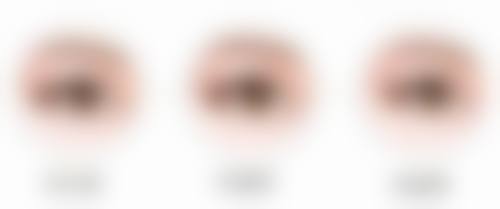 北京圣嘉医疗美容医院口碑评价与项目分享: