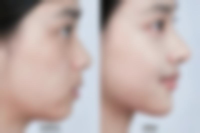 上海济爱老码头整形医院治疗反馈与口碑评价。