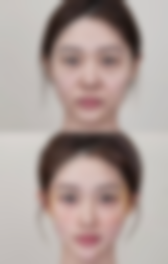 深圳黛颜（韩国MIND）整形医院口碑评价与项目分享：